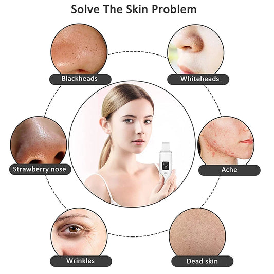 Ultrasonic Face Scrubber & EMS Facial Lifting Device – Deep Cleaning, Pore Removal & Skin Tightening