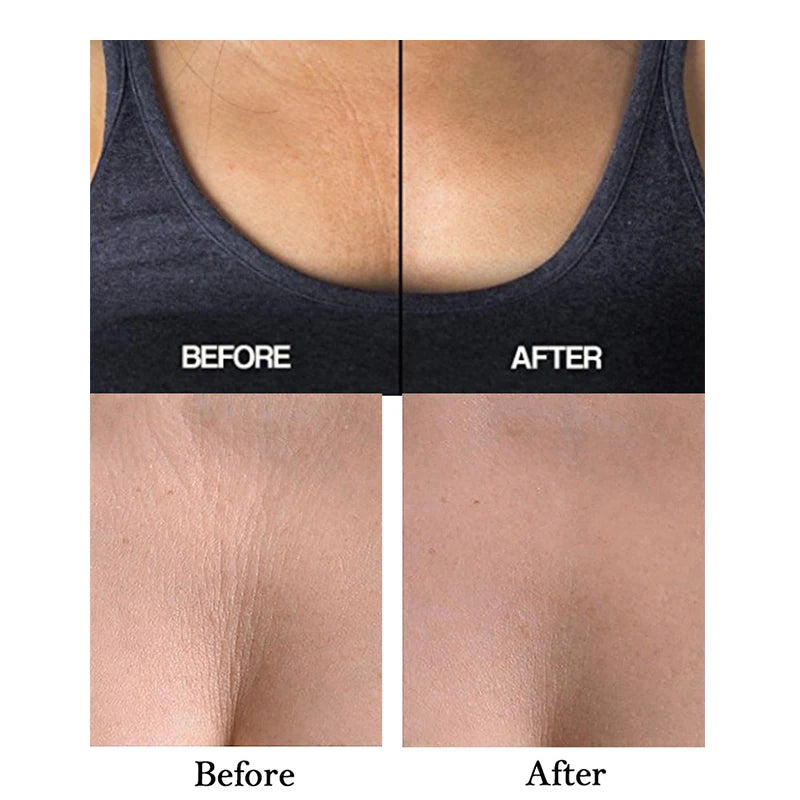 Anti-Aging Silicone Chest & Neck Pads — Wrinkle Lifting & Reusable