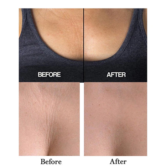 Anti-Aging Silicone Chest & Neck Pads — Wrinkle Lifting & Reusable